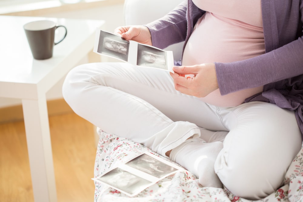 Ide-ide Mengenang Kehamilan lewat Foto-foto USG